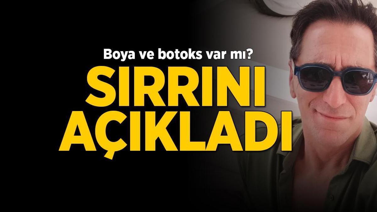 Görüntüsü hiç değişmedi Bekir Aksoy sırrını açıkladı! Botoks yaptırdı mı?