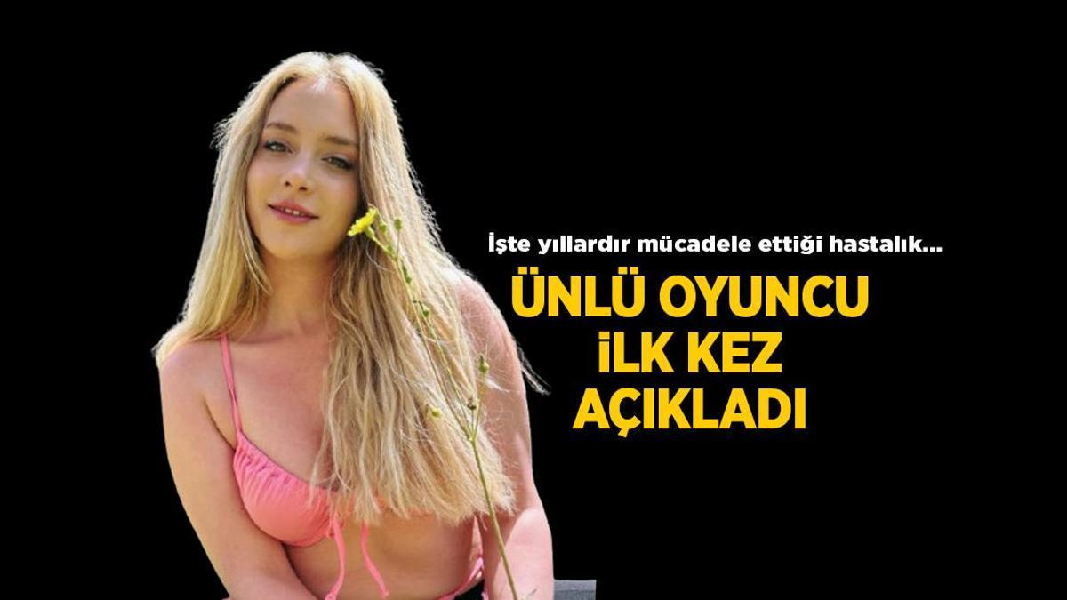 Güncel Haberler: Hayal Köseoğlu ilk kez hastalığını açıkladı! '10 yıldır OKB ile yaşıyorum'