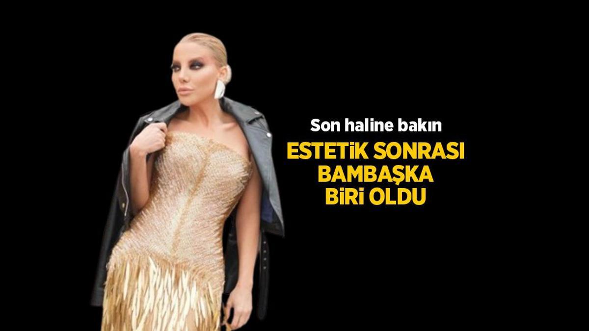 Haberler: Gülşah Saraçoğlu estetik ameliyat sonrasında bambaşka biri oldu çıktı! İşte Gülşah Saraçoğlu son hali