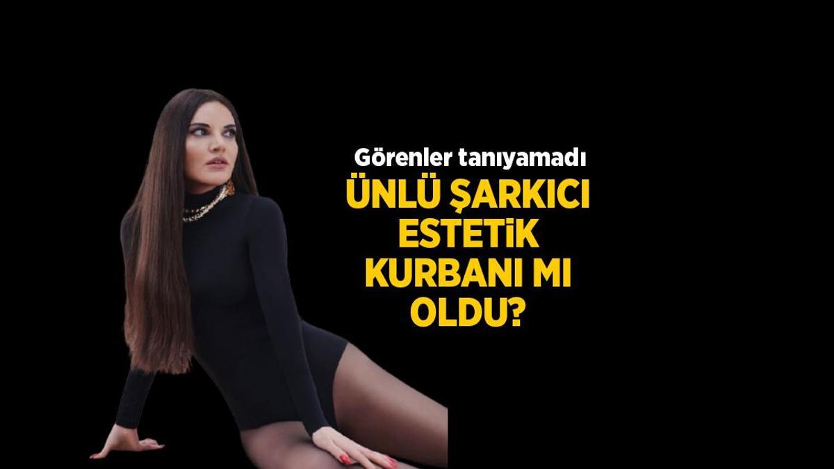 HABERLER: Şarkıcı Göksel estetik mi yaptırdı? Göksel estetikli son haline bakın