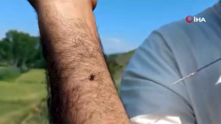Kentte ürperten görüntü! Keneler adeta kovaladı: Radarına girince kaçamıyorsun