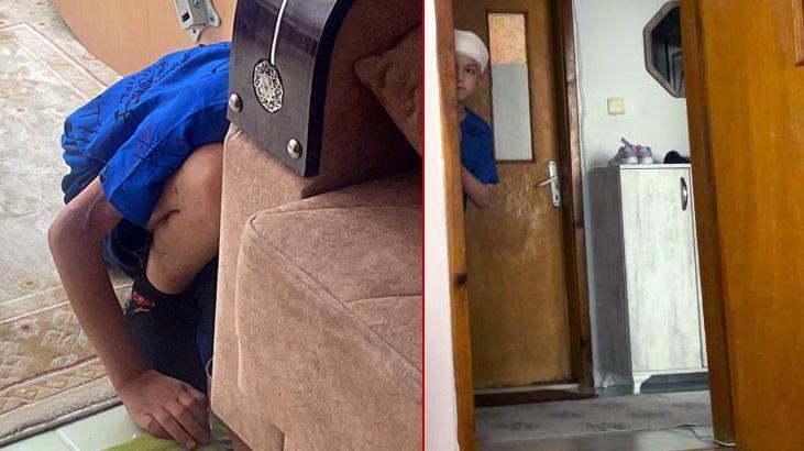 Köpeklerin ağır yaraladığı Tunahan eve kapandı, herkesten kaçıyor: Yaşaması bile bir mucize