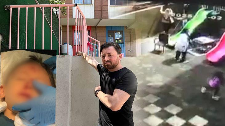 Kreşte skandal olay! 'Ufak bir kaza' diye aradılar, aile gerçeği öğrendi şoka girdi