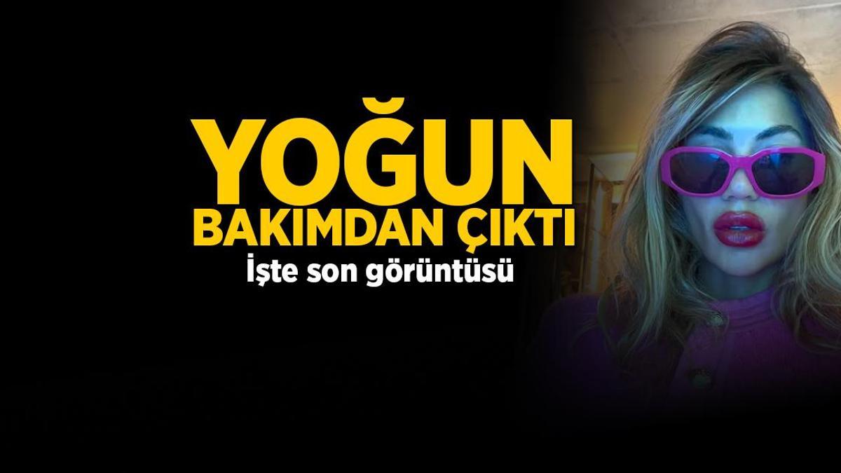 Nihal Candan sağlık durumunda son gelişme! İşte yeni görüntüsü