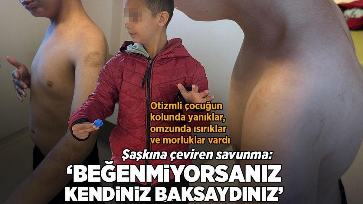 Otizmli çocuğa bakımevinde şiddet iddiası! 'Beğenmiyorsanız kendiniz baksaydınız'