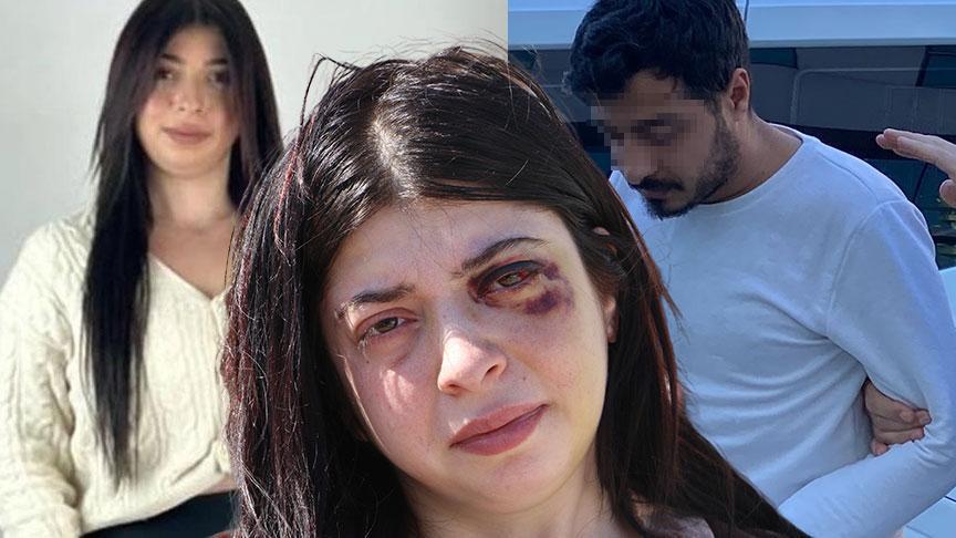 Sokak ortasında taciz edip döndü, 12 suç kaydı ortaya çıktı! Şok karar